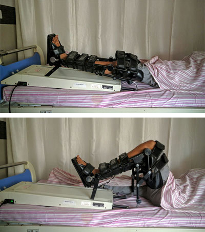 CPM Cihazı Kiralama istanbul'da